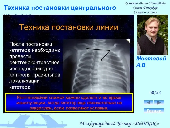 Техника постановки центрального катетера. Лекции 50/53 Мостовой А.В.