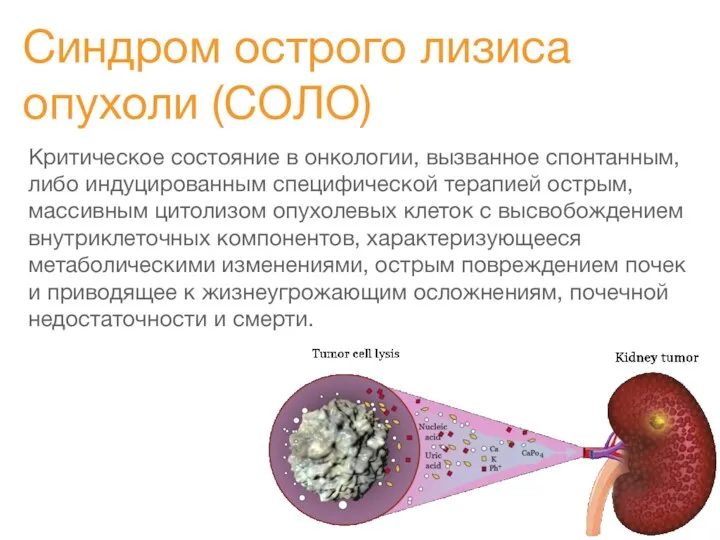 Синдром острого лизиса опухоли (СОЛО) Критическое состояние в онкологии, вызванное спонтанным,