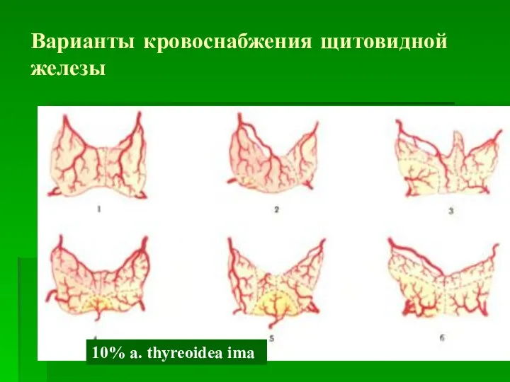 Варианты кровоснабжения щитовидной железы 10% a. thyreoidea ima