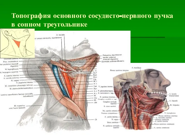 Топография основного сосудисто-нервного пучка в сонном треугольнике