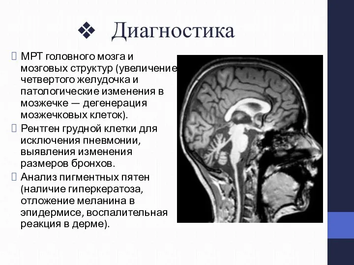 Диагностика МРТ головного мозга и мозговых структур (увеличение четвертого желудочка и