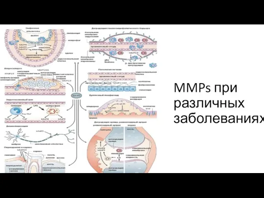 MMPs при различных заболеваниях