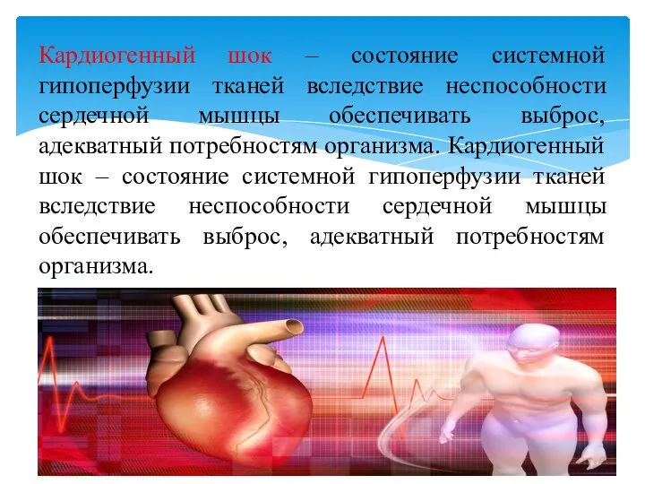 Кардиогенный шок – состояние системной гипоперфузии тканей вследствие неспособности сердечной мышцы