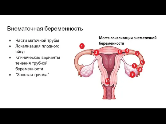 Внематочная беременность Части маточной трубы Локализация плодного яйца Клинические варианты течения трубной беременности "Золотая триада"