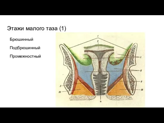 Этажи малого таза (1) Брюшинный Подбрюшинный Промежностный