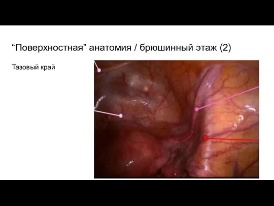 “Поверхностная” анатомия / брюшинный этаж (2) Тазовый край