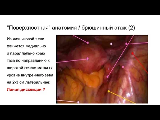 “Поверхностная” анатомия / брюшинный этаж (2) Из яичниковой ямки движется медиально