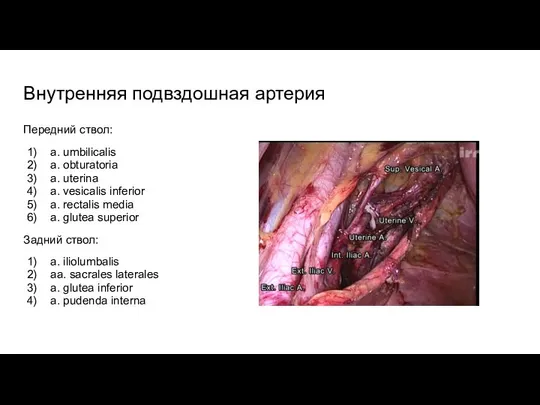 Внутренняя подвздошная артерия Передний ствол: a. umbilicalis a. obturatoria a. uterina