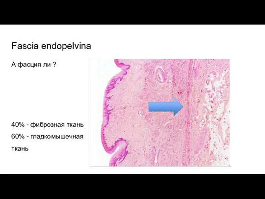 Fascia endopelvina А фасция ли ? 40% - фиброзная ткань 60% - гладкомышечная ткань