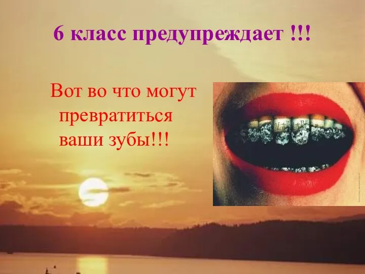 6 класс предупреждает !!! Вот во что могут превратиться ваши зубы!!!