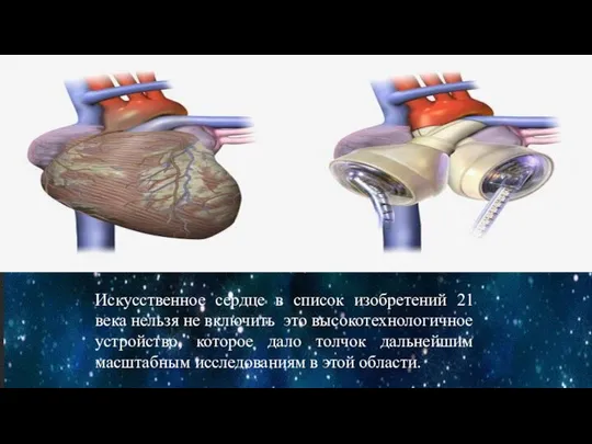 Искусственное сердце в список изобретений 21 века нельзя не включить это