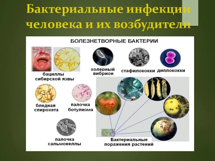Бактериальные инфекции человека и их возбудители