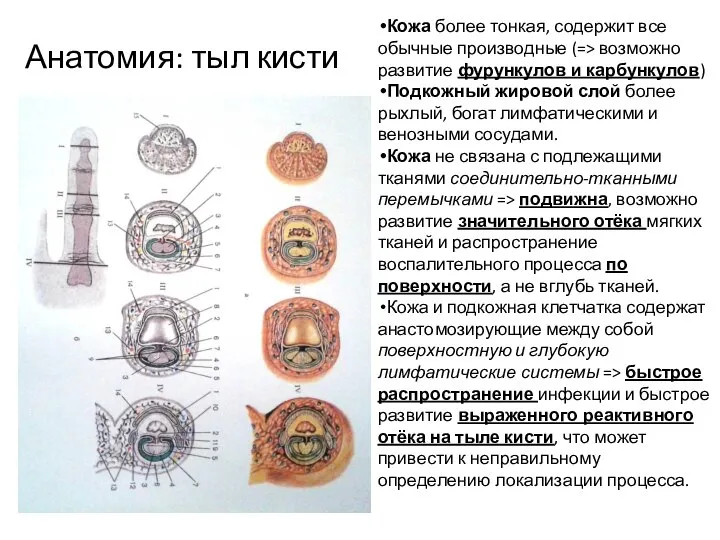 Анатомия: тыл кисти Кожа более тонкая, содержит все обычные производные (=>