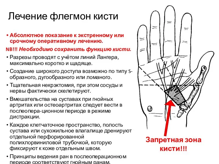 Лечение флегмон кисти Абсолютное показание к экстренному или срочному оперативному лечению.