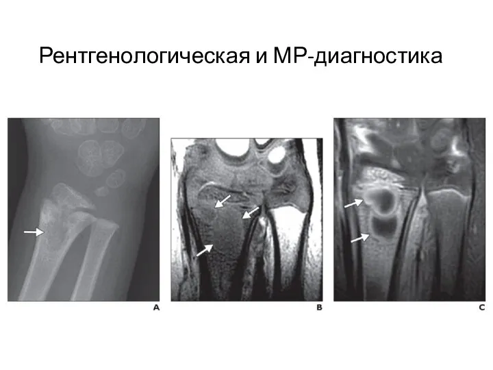 Рентгенологическая и МР-диагностика