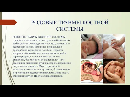 РОДОВЫЕ ТРАВМЫ КОСТНОЙ СИСТЕМЫ РОДОВЫЕ ТРАВМЫ КОСТНОЙ СИСТЕМЫ: трещины и переломы,