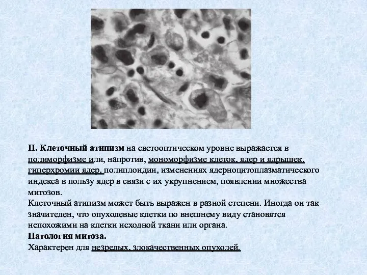 II. Клеточный атипизм на светооптическом уровне выражается в полиморфизме или, напротив,