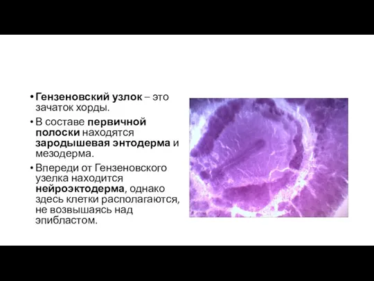 Гензеновский узлок – это зачаток хорды. В составе первичной полоски находятся