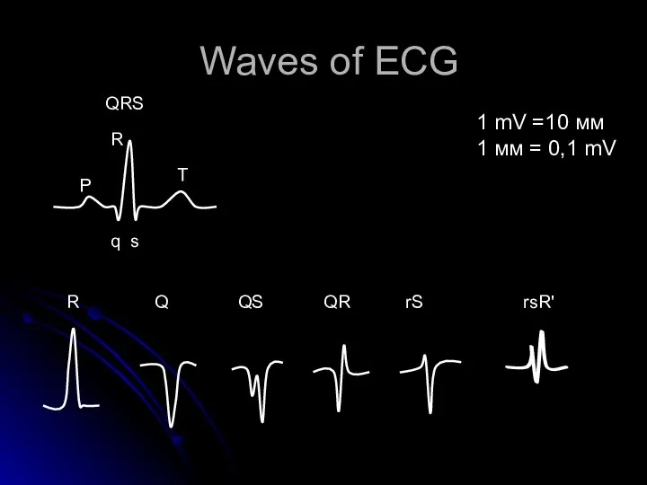 Waves of ECG Р q s T R QRS R Q