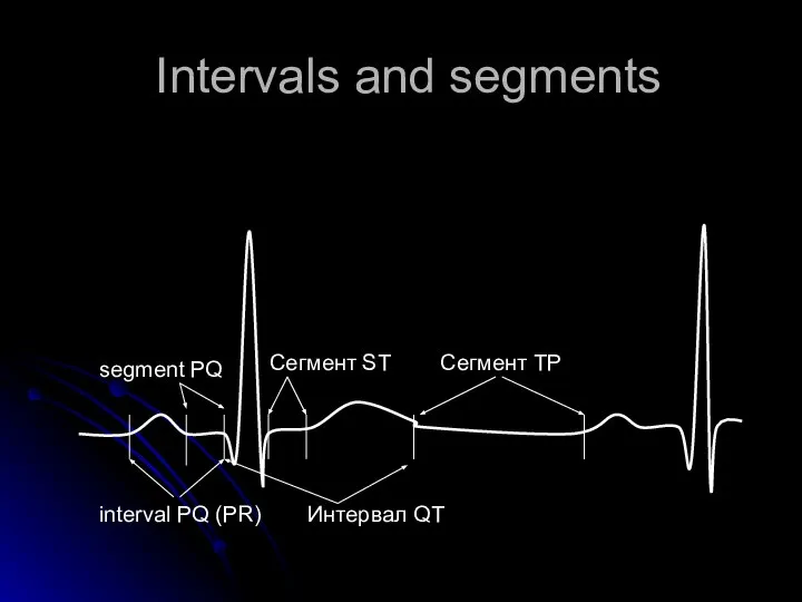 Intervals and segments interval PQ (PR) Сегмент ST segment PQ Интервал QT Сегмент ТР