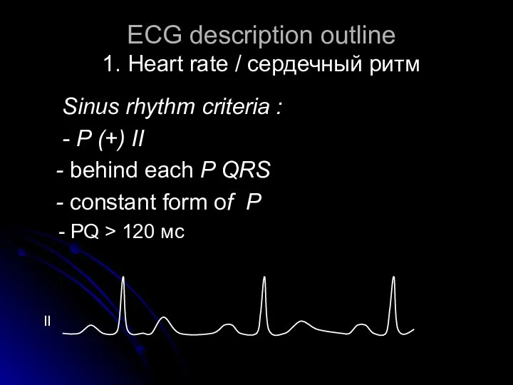 ECG description outline 1. Heart rate / cердечный ритм Sinus rhythm