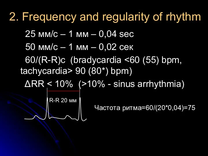 2. Frequency and regularity of rhythm 25 мм/с – 1 мм