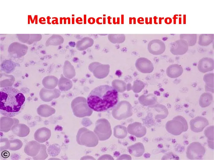 Metamielocitul neutrofil