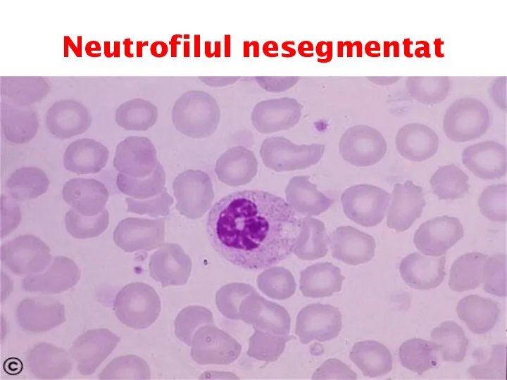 Neutrofilul nesegmentat