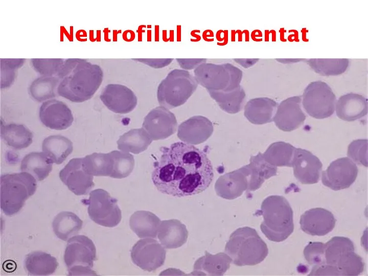 Neutrofilul segmentat