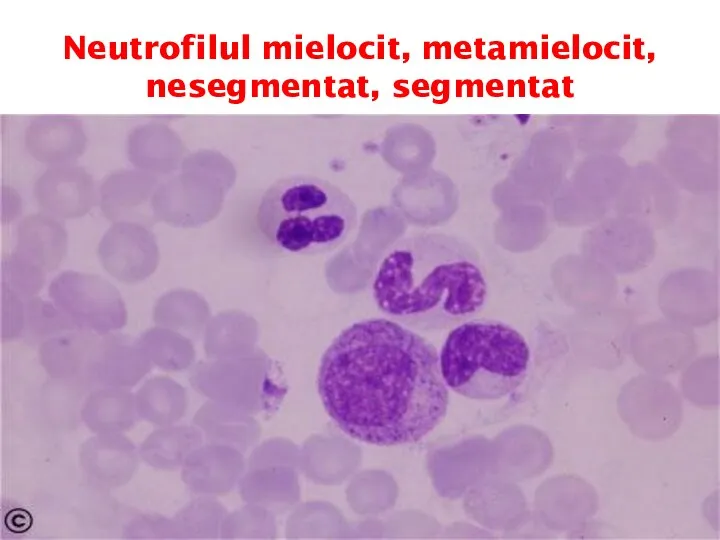 Neutrofilul mielocit, metamielocit, nesegmentat, segmentat