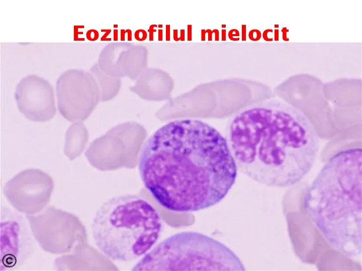 Eozinofilul mielocit