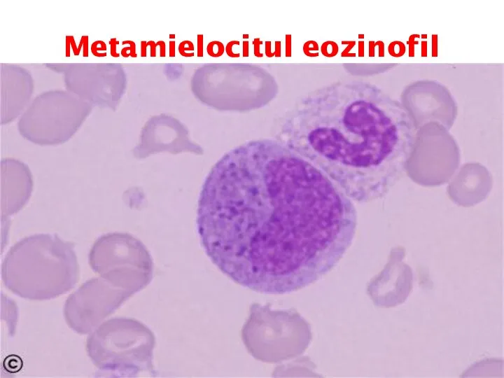 Metamielocitul eozinofil