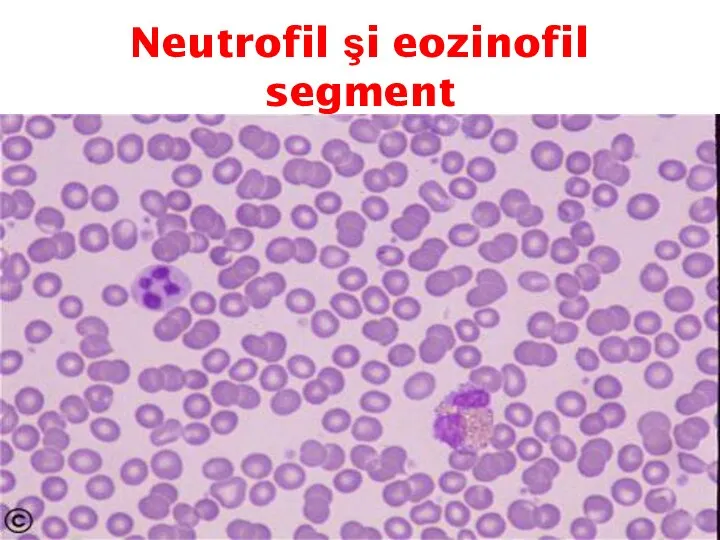 Neutrofil şi eozinofil segment