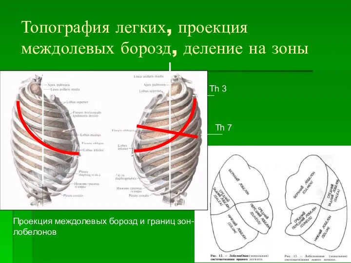 Топография легких, проекция междолевых борозд, деление на зоны Проекция междолевых борозд