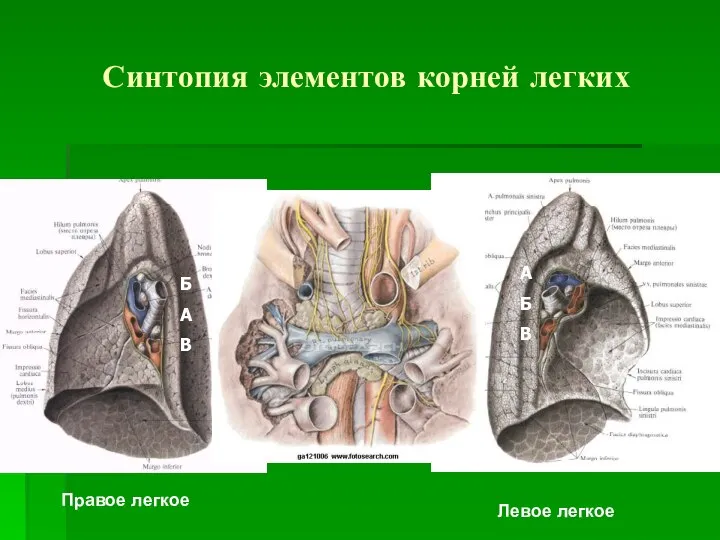 Синтопия элементов корней легких Правое легкое Левое легкое Б А В А Б В