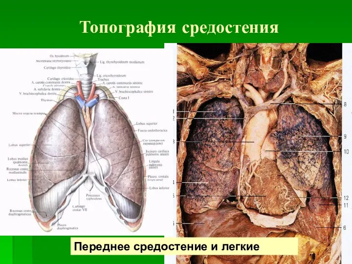 Топография средостения Переднее средостение и легкие