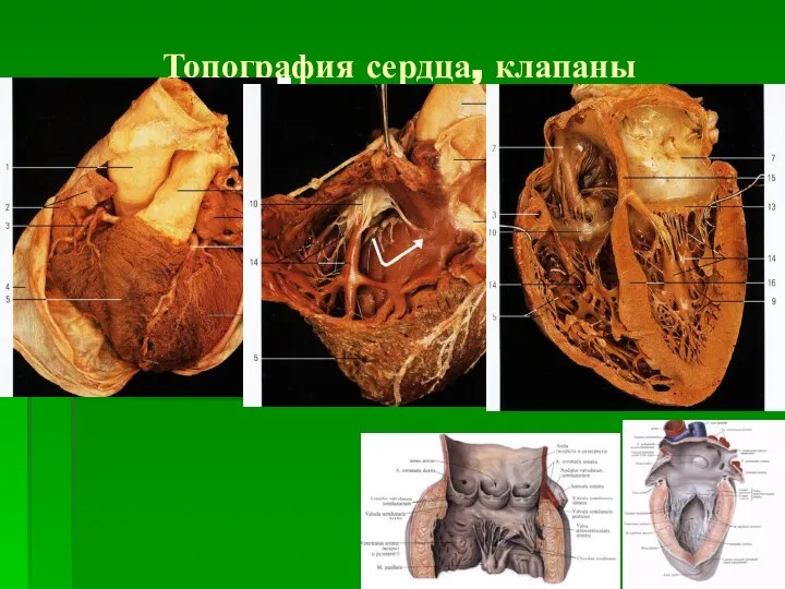 Топография сердца, клапаны