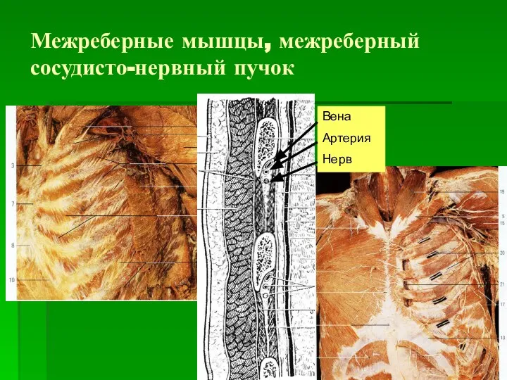 Межреберные мышцы, межреберный сосудисто-нервный пучок Вена Артерия Нерв