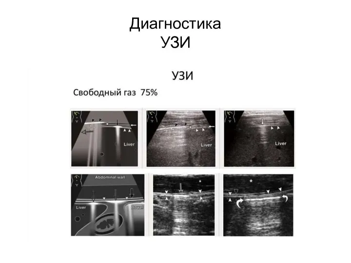 Диагностика УЗИ