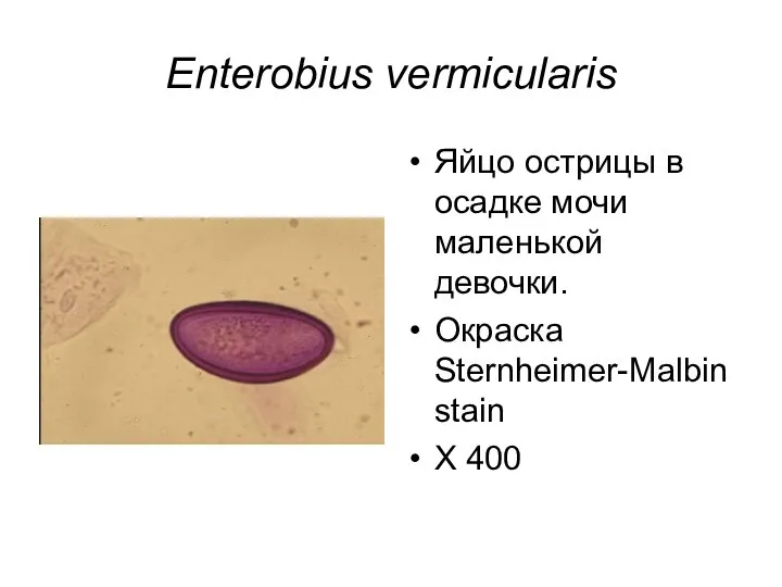 Enterobius vermicularis Яйцо острицы в осадке мочи маленькой девочки. Окраска Sternheimer-Malbin stain Х 400