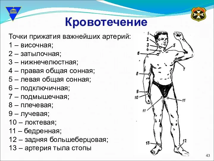 Кровотечение Точки прижатия важнейших артерий: 1 – височная; 2 – затылочная;