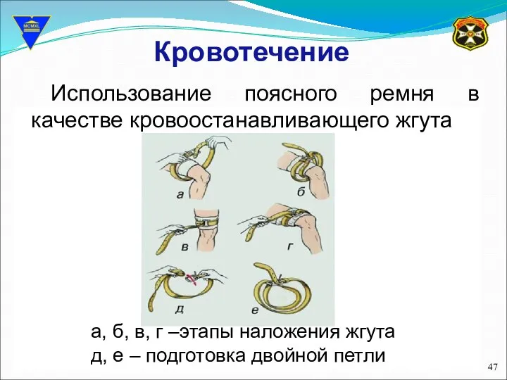 Кровотечение Использование поясного ремня в качестве кровоостанавливающего жгута а, б, в,