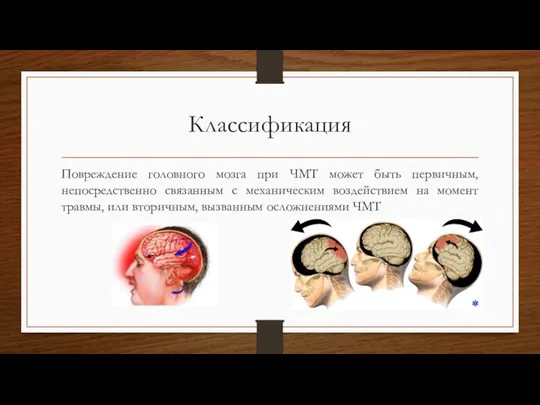 Классификация Повреждение головного мозга при ЧМТ может быть первичным, непосредственно связанным