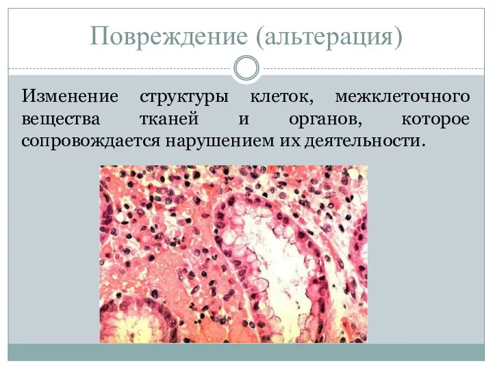 Повреждение (альтерация) Изменение структуры клеток, межклеточного вещества тканей и органов, которое сопровождается нарушением их деятельности.