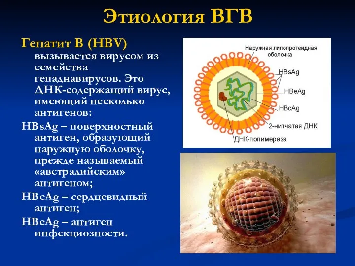 Этиология ВГВ Гепатит В (HВV) вызывается вирусом из семейства гепаднавирусов. Это