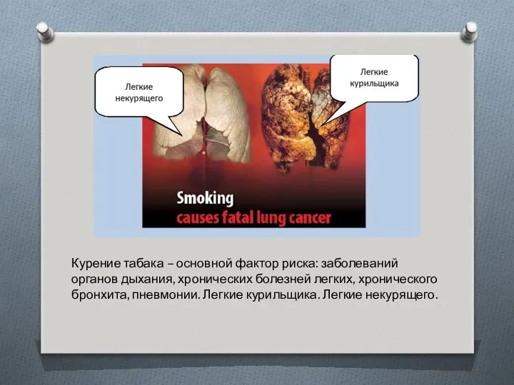 Курение табака – основной фактор риска: заболеваний органов дыхания, хронических болезней