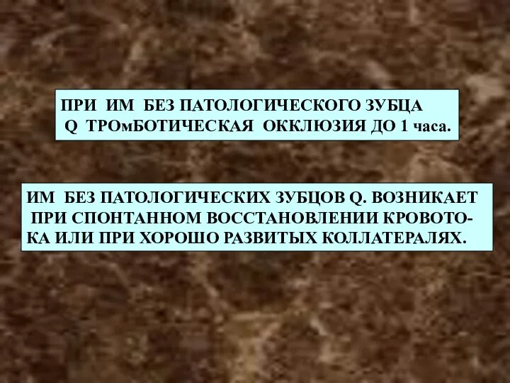 ПРИ ИМ БЕЗ ПАТОЛОГИЧЕСКОГО ЗУБЦА Q ТРОмБОТИЧЕСКАЯ ОККЛЮЗИЯ ДО 1 часа.