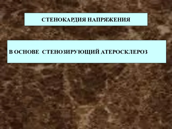 СТЕНОКАРДИЯ НАПРЯЖЕНИЯ В ОСНОВЕ СТЕНОЗИРУЮЩИЙ АТЕРОСКЛЕРОЗ