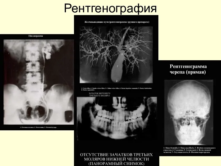 Рентгенография