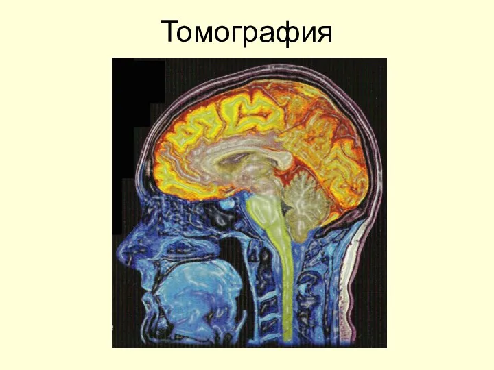 Томография